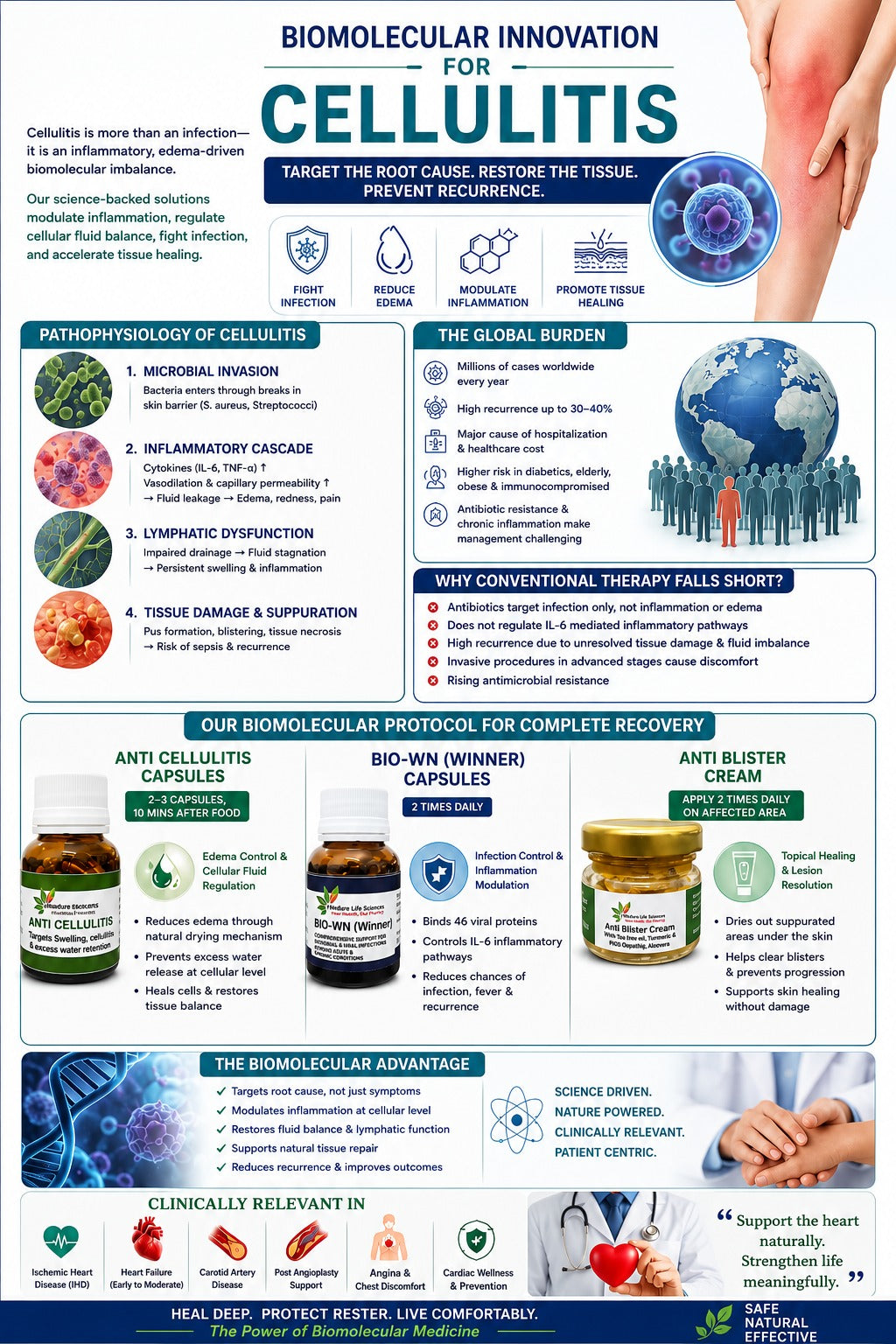 CELLULITIS