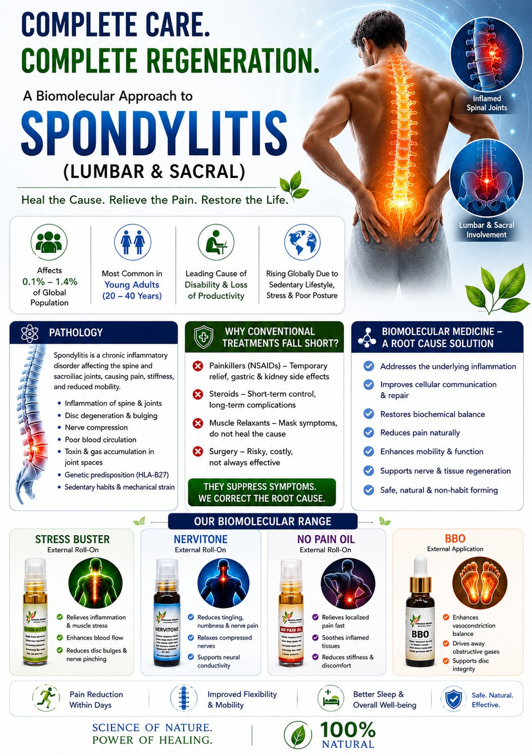 SPONDYLITIS